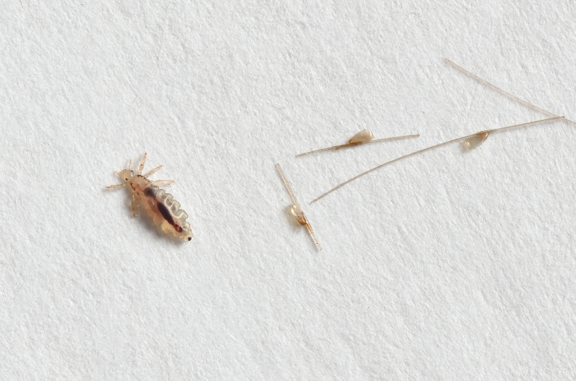 Lice control，Lice pest control (8)